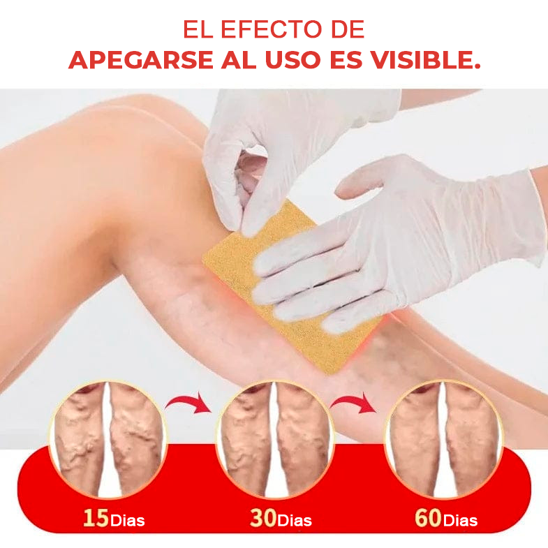 Veins Parche Anti-varices [COMPRE 6, LEVE 12🎁]